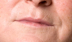 Face-Wrinkles-Sagging-Skin